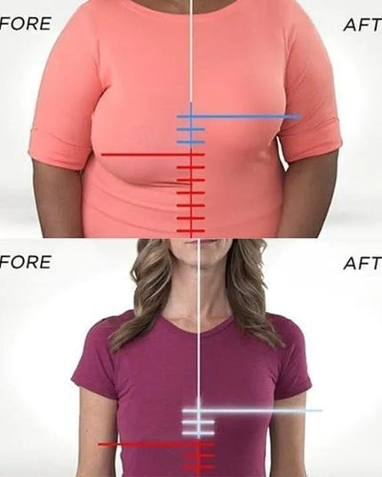 Lyro™ | SoftSupport Bra